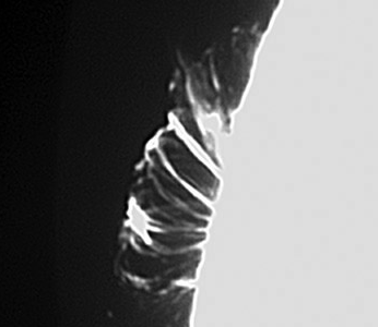 images/stories/od1-to-od7-ani.gif images/stories/od1-to-od7-ani.gif